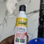CALLUS REMOVAL
